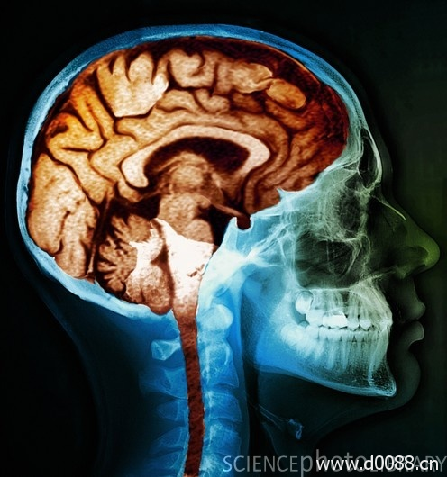 brain-effects12